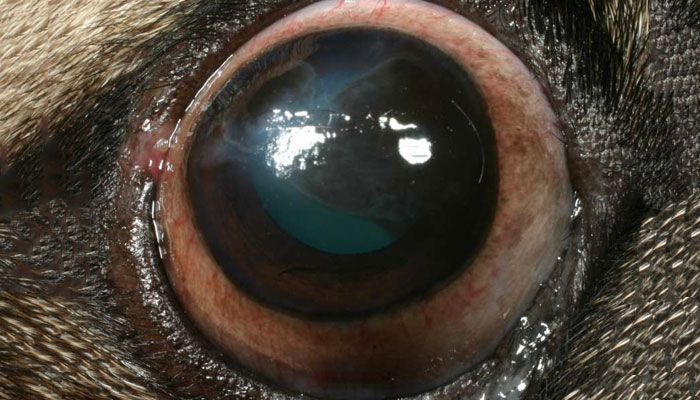 Ojo inflamado - Causas y tratamientos